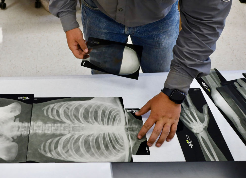 Students use X-rays to learn about bones